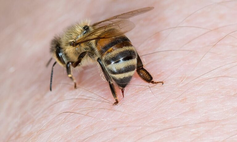 Chữa bệnh khớp bằng ong châm có thực sự hiệu quả?