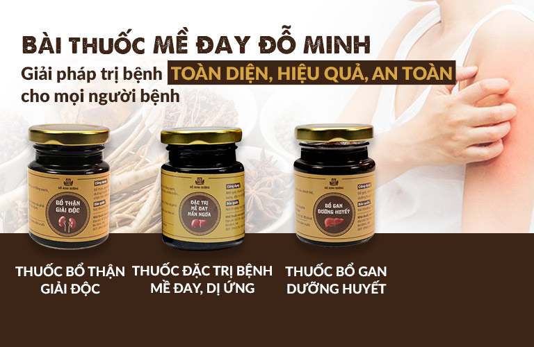 Bài thuốc Mề Đay Đỗ Minh