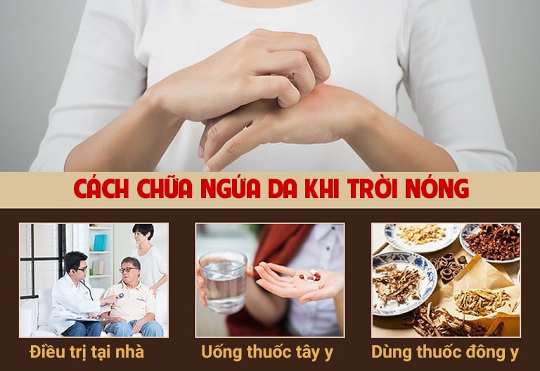 Các phương pháp điều trị ngứa da trời nóng phổ biến nhất