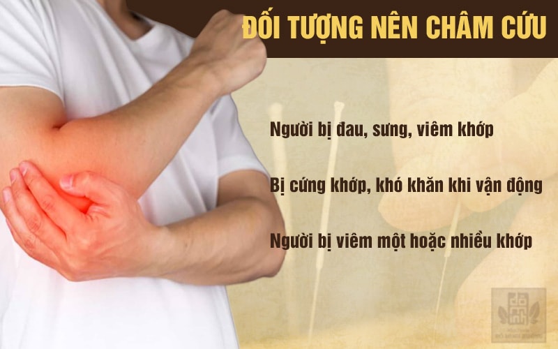 Lưu ý khi tiến hành điều trị viêm khớp bằng châm cứu