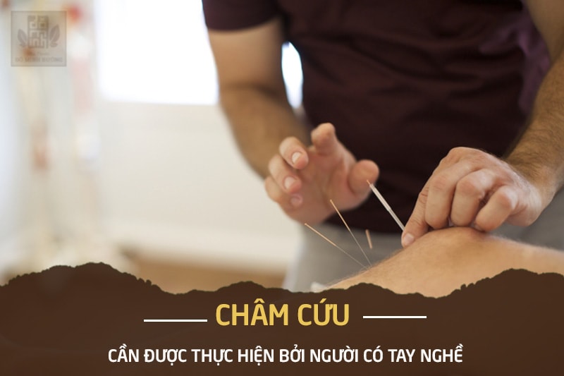 Trị bệnh viêm khớp bằng châm cứu cần đúng cách