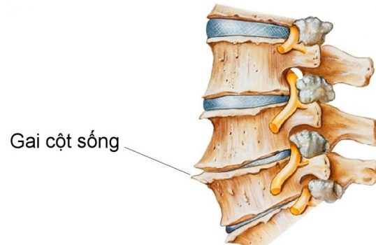 hinh-anh-gai-cot-song