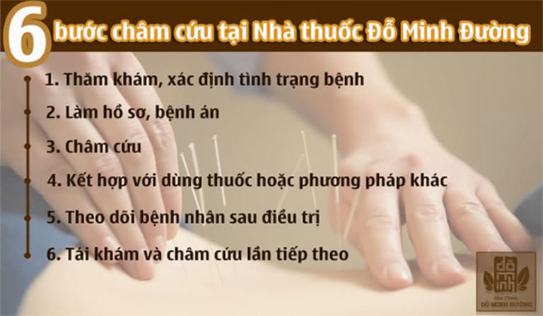 Quy trình châm cứu tại nhà thuốc Đỗ Minh Đường