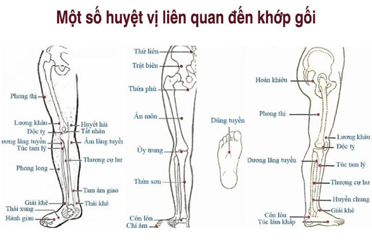 Điều trị thoái hóa khớp gối bằng châm cứu