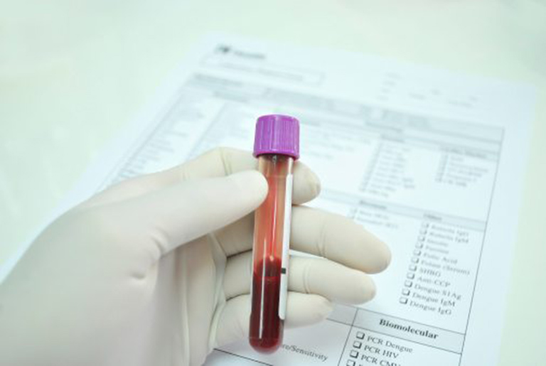 Những lưu ý cần biết khi thực hiện xét nghiệm máu nổi mề đay