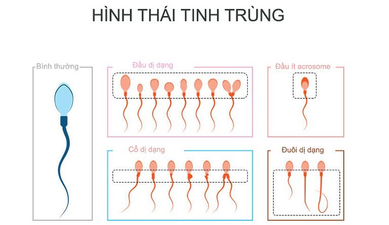 tinh trùng dị dạng có thai tự nhiên được không