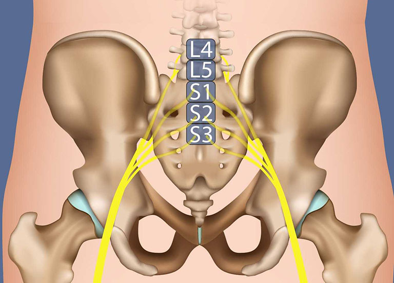 Đau thần kinh tọa