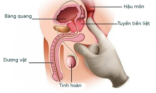 Viêm tuyến tiền liệt