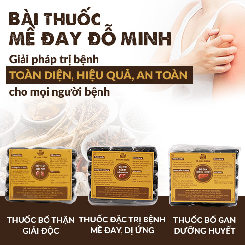 Khám phá bài thuốc Mề Đay Đỗ Minh