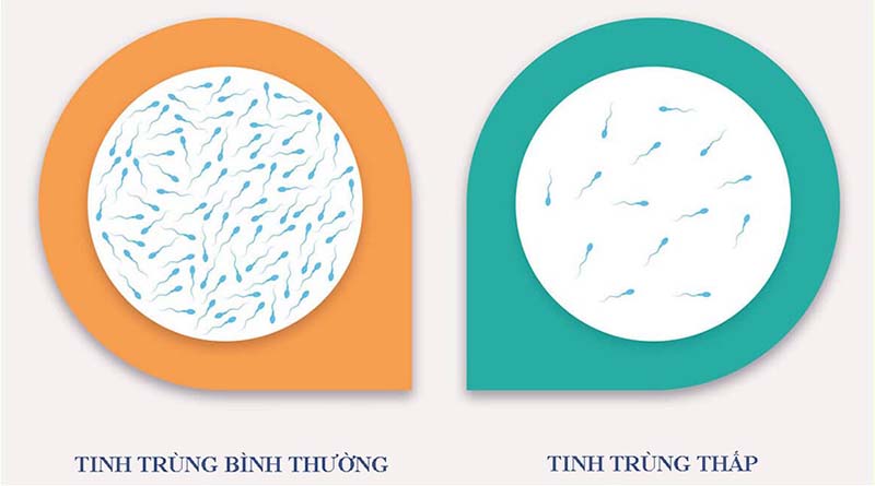 Dấu hiệu tinh trùng loãng