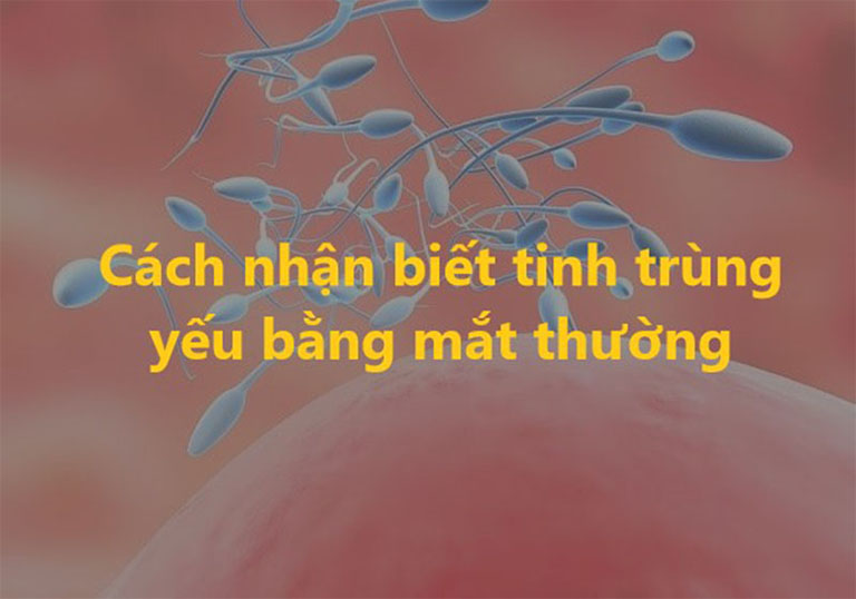 kiểm tra tinh trùng bằng mắt thường