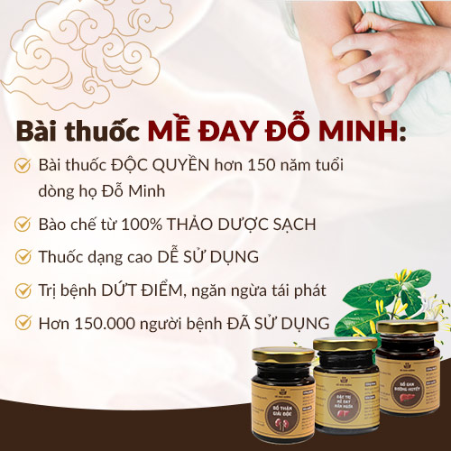 Công dụng  bài thuốc Mề Đay Đỗ Minh