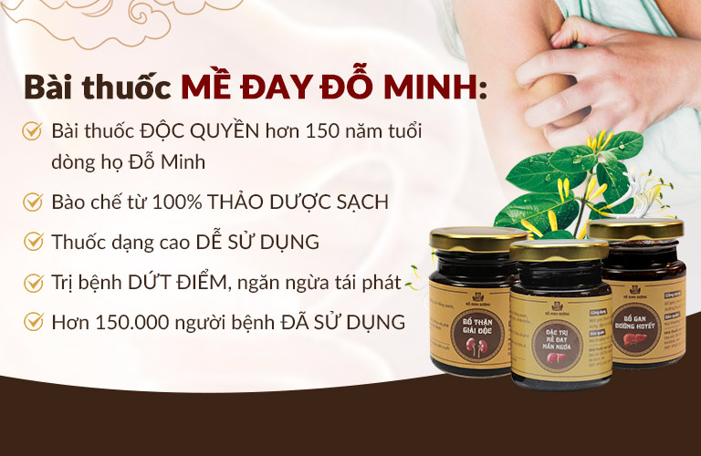 Ưu điểm vượt trội bài thuốc Mề Đay Đỗ Minh