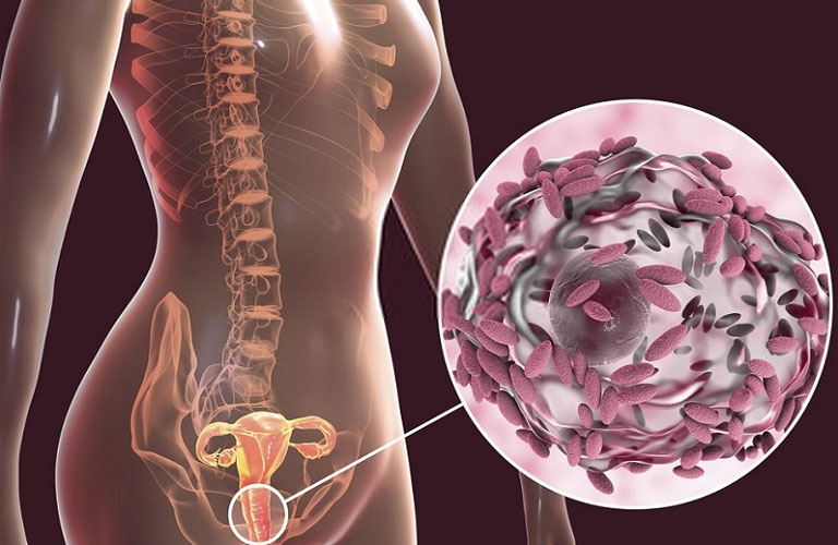 vi khuẩn Gardnerella Vaginalis là gì
