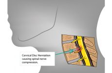 chua-thoat-vi-dia-dem-co-1