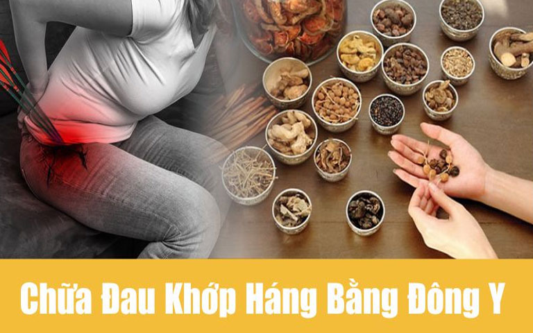 Chữa Thoái Hóa Khớp Háng Bằng Đông Y - Giải Pháp An Toàn Và Hiệu Quả