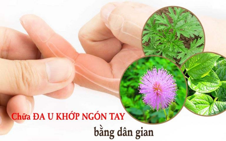 Chữa đau khớp ngón tay bằng dân gian