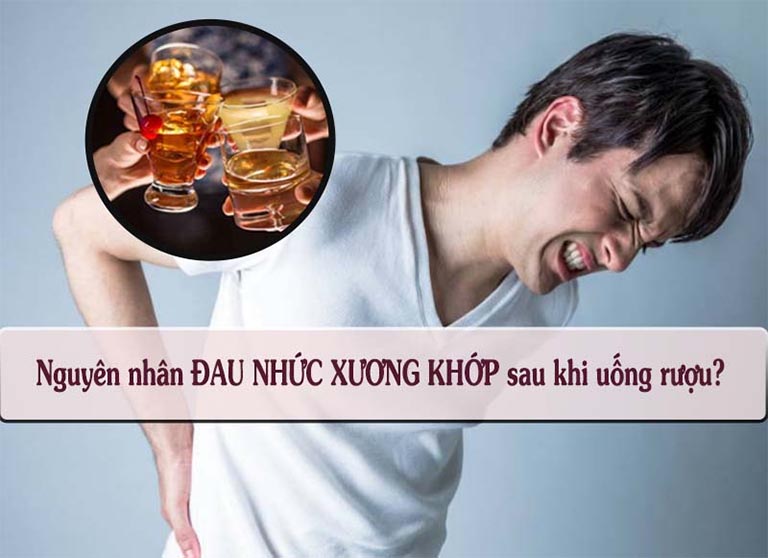 Đau nhức xương khớp sau khi uống rượu bia 