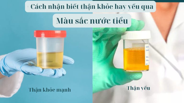 Quan sát màu sắc nước tiểu giúp nhận biết thận khỏe hay yếu chính xác tại nhà 