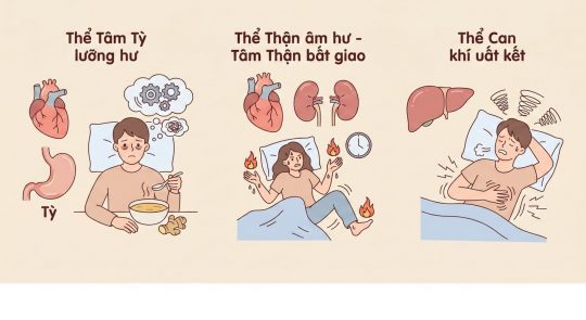 Giải mã 3 thể mất ngủ do rối loạn tạng phủ và cách bồi bổ khí huyết
